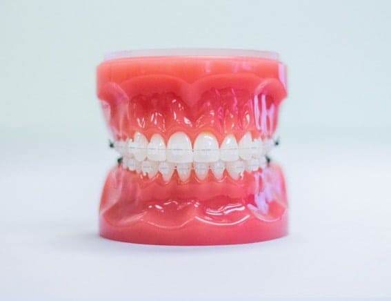 Clear Braces from Orthodontic Associates